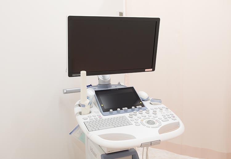 4D超音波検査装置(エコー)